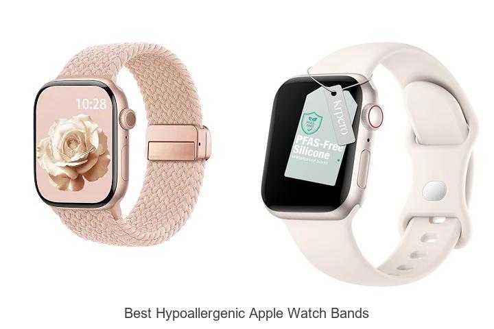 best hypoallergenic apple watch bands